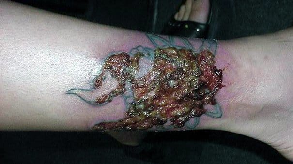 tattoo infection abnormal scabbing